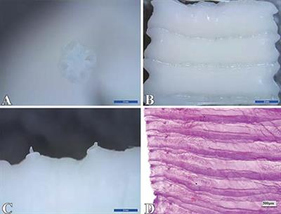 Moniezia benedeni Infection Restrain IgA+, IgG+, and IgM+ Cells Residence in Sheep (Ovis aries) Small Intestine